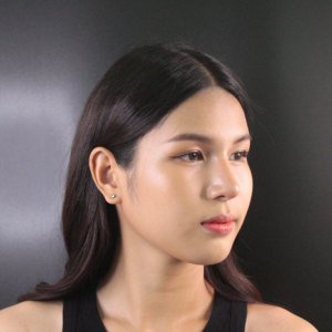 ฟิลเลอร์ร่องแก้ม (Nasolabial filler)