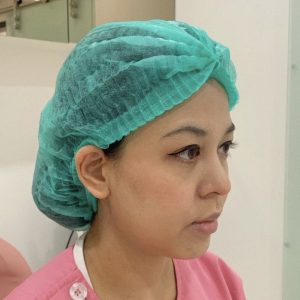 ร้อยไหมกระตุ้นคอลลาเจน